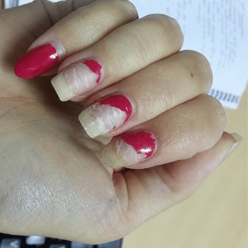 After